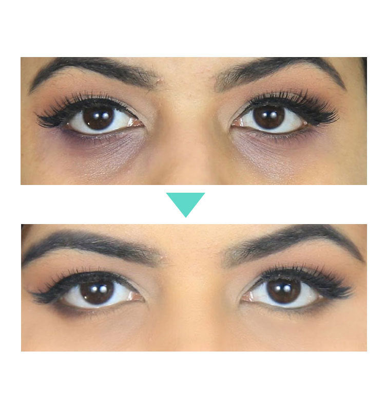 Anti-Aging Eye Cream - Hydrating Under Eye Cream