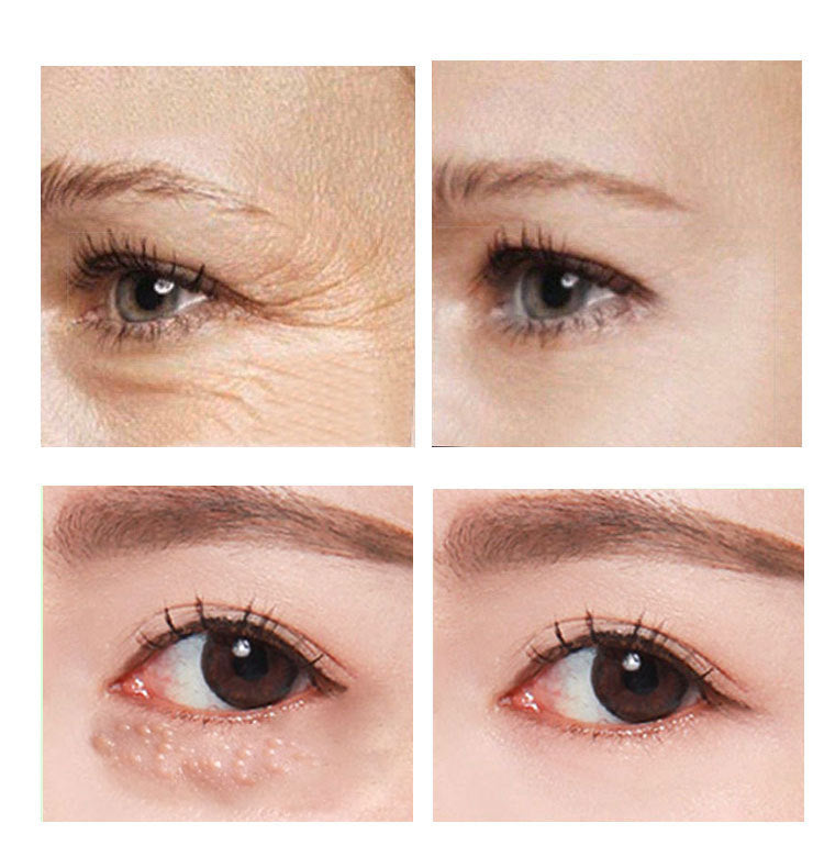 Anti-Aging Eye Cream - Hydrating Under Eye Cream