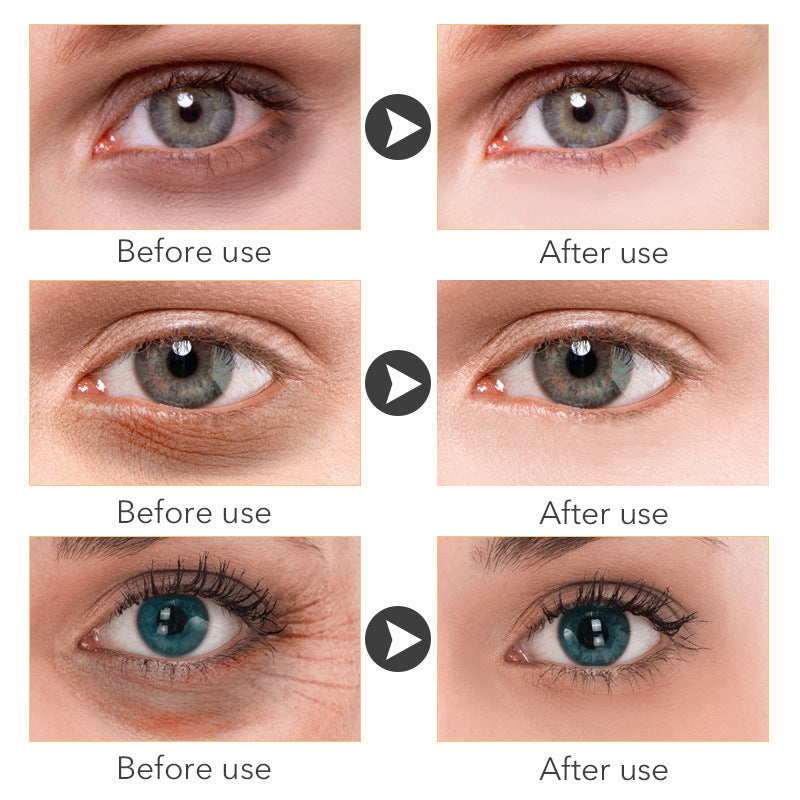 Anti-Aging Eye Cream - Hydrating Under Eye Cream
